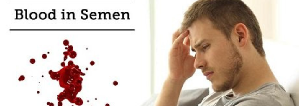 Everything to know about blood in semen